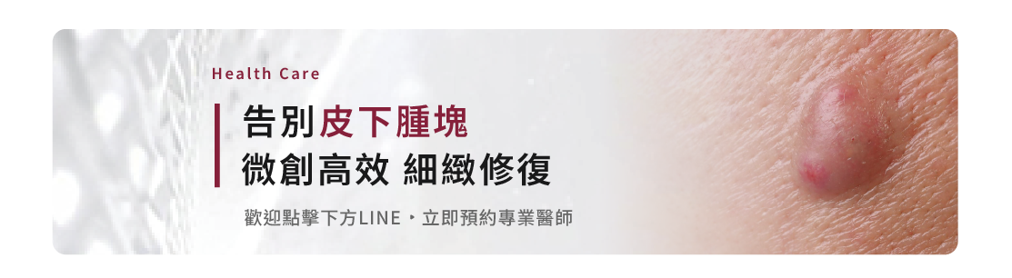 粉瘤微創手術怎麼做？脂肪瘤、肉芽、雞眼怎麼分？專業醫師教你皮膚腫塊居家自檢